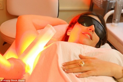 Hỏng da vì công nghệ triệt lông tia laser 'thần thánh'