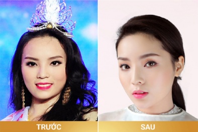 Thẩm mỹ viện bất ngờ lên tiếng ‘vạch mặt’ Hoa hậu Kỳ Duyên nói dối