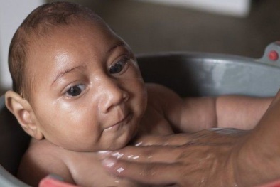 Cô gái Hàn Quốc nghi nhiễm virus Zika khi từ Việt Nam trở về 