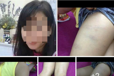 Bắc Ninh: Giáo viên đánh học sinh tím người vì không làm bài tập