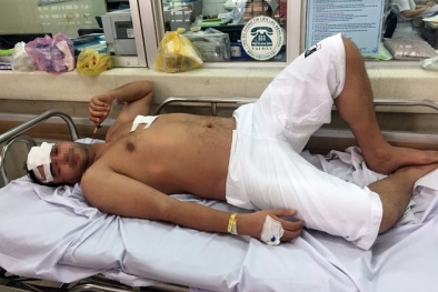 Người đàn ông nước ngoài bị đâm ở Sài Gòn vì đuổi theo cướp