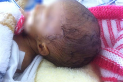 Lâm Đồng: Gia đình bức xúc truy hỏi bác sĩ về vết khâu trên đầu bé sơ sinh