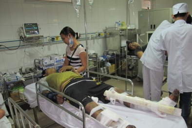 Đôi mắt đau đớn của nạn nhân sống sót sau vụ xe khách phát nổ kinh hoàng