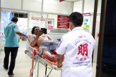 'Của quý' bị cắt phăng vì lăng nhăng với bạn thân của vợ