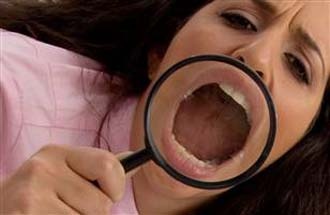 Kỳ lạ chuyện ung thư da xuất hiện ở miệng 