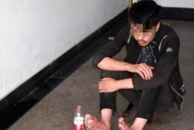 Hai chân thối rữa vì mải 'cày' game liền 6 ngày đêm không tắm