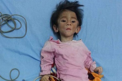 Bé gái 14 tháng tuổi bị đói lâu ngày chỉ nặng 3,5 kg, giờ ra sao?