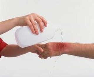 Cảnh giác ung thư da do rửa vết thương bằng oxy già