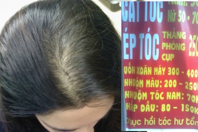 Nguy cơ hói đầu vì ‘nghiện’ ép tóc giá rẻ