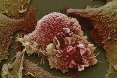 Báo động: Trẻ 2 tuổi đã bị ung thư tinh hoàn, 9 tuổi ung thư dạ dày