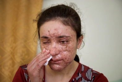 ‘Địa ngục’ hiện hình trên khuôn mặt cô bé 18 tuổi bị ép làm nô lệ tình dục IS