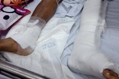 Trớ trêu bệnh nhân lại là người đầu tiên phát hiện mổ nhầm chân