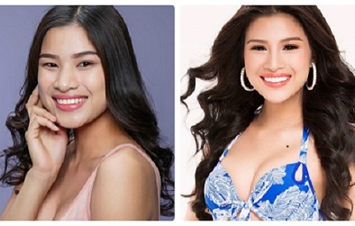 Ngắm nhan sắc thí sinh gây tranh cãi Nguyễn Thị Thành HHVN trước và sau tai nạn bọc răng