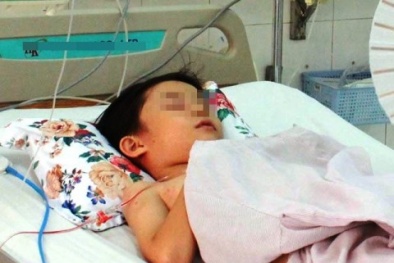 Bé trai 6 tuổi phải lọc máu suốt 2 ngày do bị hàng trăm con ong đốt