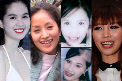 Những hàm răng 'đau khổ' của sao Việt chỉ muốn chôn vùi vào quá khứ