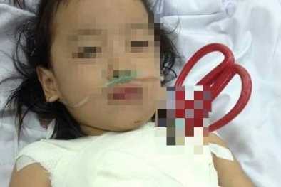 Bé 5 tuổi bị kéo đâm xuyên ngực đang suy hô hấp