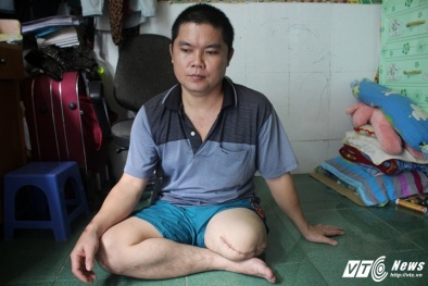 Đã có kết luận vụ nam thanh niên bị cưa cụt chân tố bệnh viện tắc trách