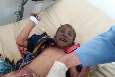 Tình hình chiến sự Syria mới nhất: 'Chấn động em bé Napalm Syria'