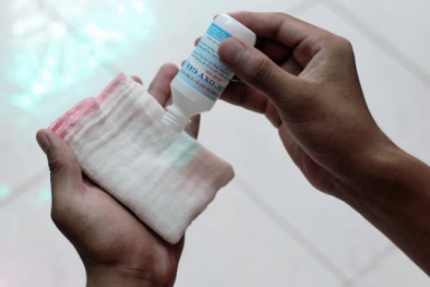 Cồn, ôxy già mua dễ nhưng đừng dùng bừa