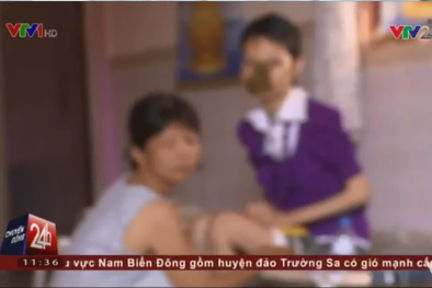 Dùng đông dược không rõ nguồn gốc, mặt lở loét, thối rữa?