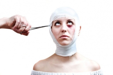 Tai biến khôn lường từ phẫu thuật thẩm mỹ