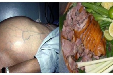 Những nguy cơ 'chết người' nếu ăn phải thịt chó nhiễm sán