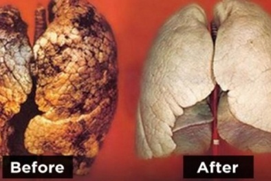 Tuyệt chiêu đặc biệt ngừa ung thư phổi chỉ trong 3 ngày