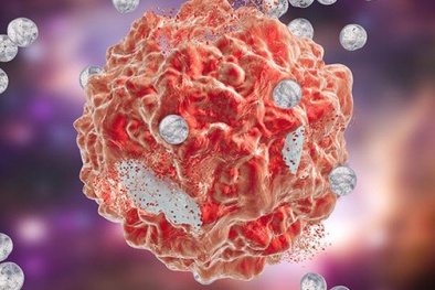 Các nhà khoa học đã phát hiện thêm một cách chữa ung thư 