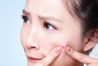 9 nguyên nhân gây mụn trứng cá bạn không nên bỏ qua
