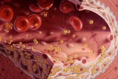Mỡ máu, tiêu hóa, ung thư được 'quét sạch' với loại nước dễ làm