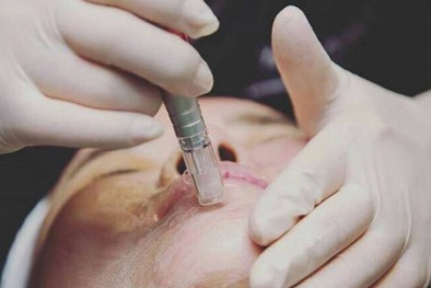 Chuyên gia khuyến cáo: Cấy phấn vào da, coi chừng mang bệnh