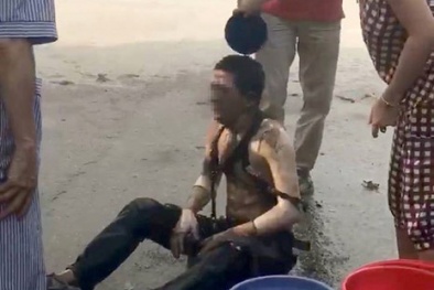 Trạm biến áp nổ: Sai lầm nghiêm trọng khi sơ cứu người bị bỏng 