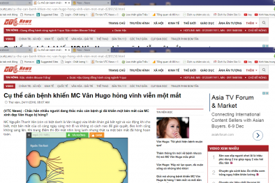 Cụ thể căn bệnh khiến MC Vân Hugo hỏng vĩnh viễn một mắt