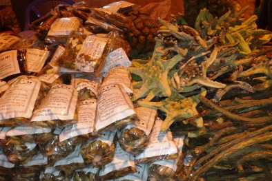 Hoại tử thận vì dùng thuốc nam trị sỏi