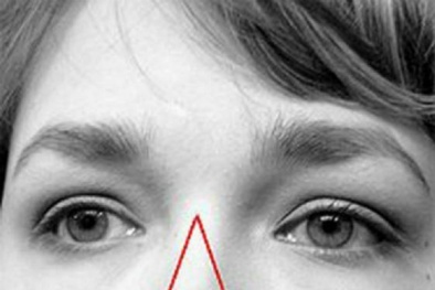 Cảnh báo nhiễm trùng dẫn đến tử vong khi nặn mụn ở mũi, mặt