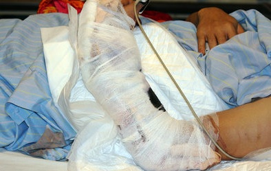 Tin cảnh báo nổi bật: Bé trai bị hỏng mắt, cắt bàn tay do nghịch đồ điện phát nổ