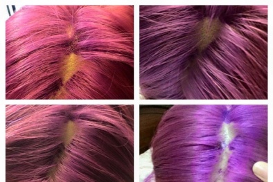 Đừng cược tính mạng mình với 'tử thần' sớm vì trào lưu tẩy tóc