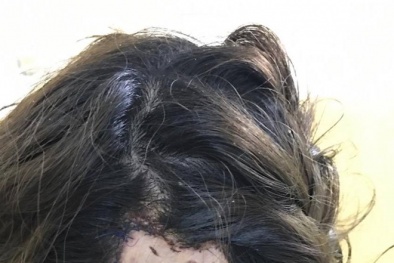 Làm tóc đón Tết: Cẩn thận kẻo tiền mất tật mang