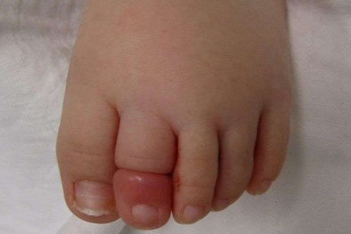 Nguy hiểm: Trẻ nhỏ có thể cụt tay, mất mạng vì một sợi tóc rụng của mẹ