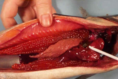 Người đàn ông suýt chết vì uống mật cá trắm pha rượu 