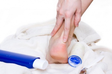 Vết chai trên cơ thể 'ẩn giấu' bệnh nguy hiểm không nên xem thường