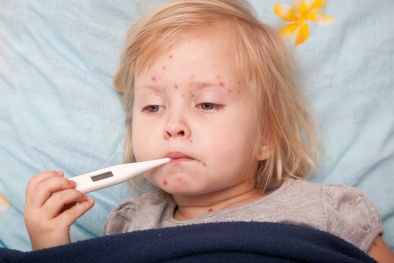 Triệu chứng và cách phòng ngừa bệnh thủy đậu