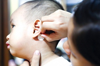 Trẻ có nguy cơ rối loạn hành vi vì miếng dán chống nôn 