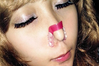 Người dùng chuốc họa vì kẹp nâng mũi tại nhà