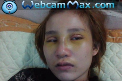  'Lãnh đủ' vì tin lời 'chuyên gia Facebook' mách nước làm đẹp