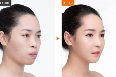 Phẫu thuật thẩm mỹ: Cơ hội đổi đời có thực sự dễ dàng đến vậy? 