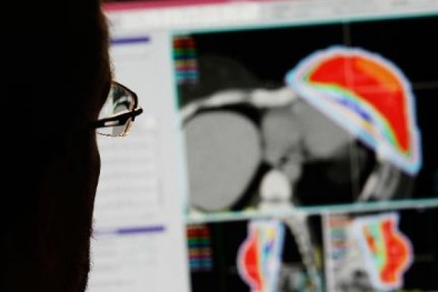 Nga: Các nhà khoa học dự báo sắp có thuốc điều trị mọi loại ung thư