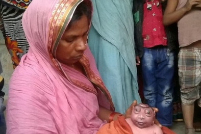 Ấn Độ: Kỳ lạ bé sơ sinh giống hệt người ngoài hành tinh