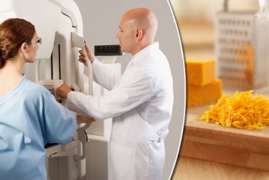 Ăn nhiều phô mai phụ nữ dễ bị ung thư vòng một