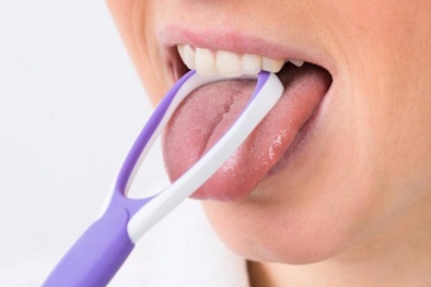 5 tác hại 'không ngờ' khi quên vệ sinh lưỡi